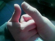 School Disciplines 8 y.o. for Thumb Wrestling — There’s “A Potential for Injury!” It's a slippery slope to atomic warfare.