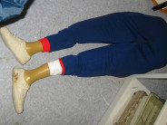 Not the actual suspicious leg. But you get the idea. (Photo from Clints Work) 