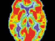 “Neuroscience Says ________ Will Harm Your Kids!” This is your brain on a blog.